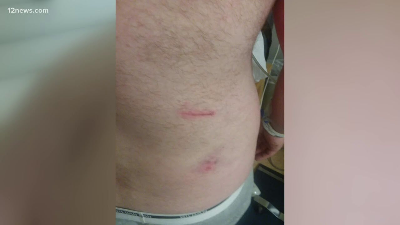 Man attacked by Banner security after experience a medical episode
